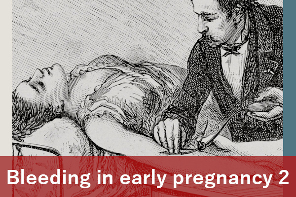 Bleeding in early pregnancy 2