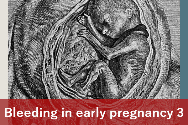 Bleeding in early pregnancy 3